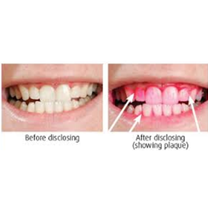 Alat Kedokteran Gigi