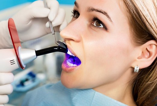 Fungsi dan Penggunaan Dental Curing Light dalam Kedokteran Gigi