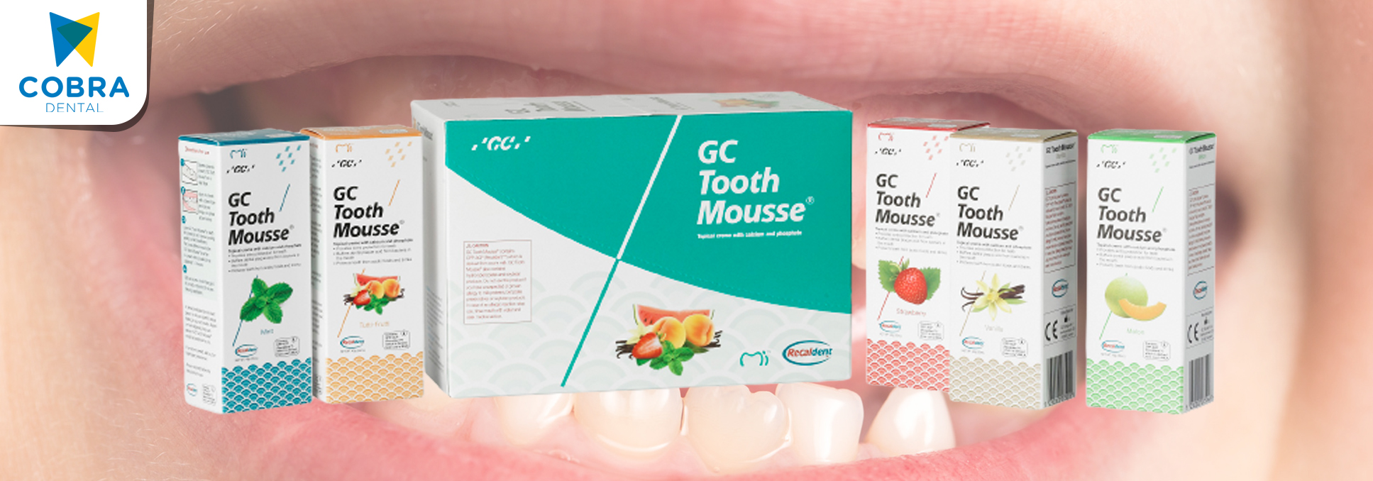 GC Tooth Mousse: Krim pelindung ekstra gigi Si Kecil dari Karies!